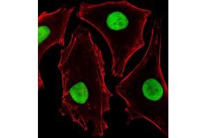 Fluorescent image of Hela cells stained with SUMO2 Antibody (C-term) B. (SUMO2 抗体)