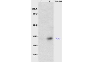 Lane 1: mouse brain lysates Lane 2: mouse heart lysates probed with Anti TUSC3 Polyclonal Antibody, Unconjugated (ABIN762656) at 1:200 in 4 °C. (TUSC3 抗体  (AA 201-300))