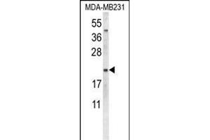 Western blot analysis of NEU1 Antibody (Center) (ABIN653650 and ABIN2842991) in MDA-M cell line lysates (35 μg/lane). (NEU1 抗体  (AA 11-40))