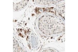 Immunohistochemical staining of human testis with GAPT polyclonal antibody  shows strong granular cytoplasmic positivity in leydig cells. (GAPT 抗体)