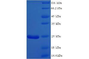 SDS-PAGE (SDS) image for Chromosome 15 Open Reading Frame 48 (C15ORF48) (AA 1-83), (full length) protein (His-SUMO Tag) (ABIN5711477)