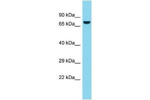 Host: Rabbit  Target Name: Atg7  Sample Tissue: Rat Thymus lysates  Antibody Dilution: 1. (ATG7 抗体  (C-Term))
