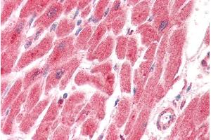 Immunohistochemistry (IHC) image for anti-Prostaglandin E Synthase 2 (PTGES2) (AA 292-306) antibody (ABIN5539612)