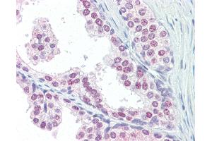 Anti-UBC / Ubiquitin C antibody IHC of human prostate. (UBC 抗体  (AA 36-66))