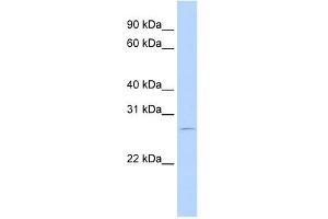 RBM38 antibody used at 0. (RBM38 抗体  (N-Term))