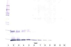 Image no. 2 for anti-Interleukin 5 (IL5) antibody (ABIN465636) (IL-5 抗体)