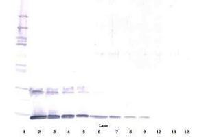 Image no. 2 for anti-Interleukin 5 (IL5) antibody (ABIN465636)