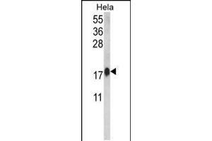 Western blot analysis of CALM1 Antibody in Hela cell line lysates (35ug/lane)(2ug/ml) (Calmodulin 1 抗体  (C-Term))