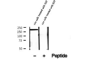 Western blot analysis of extracts of cos cells trested with EGF, using Phospho-HER2/ErbB2 (Tyr1221/1222) Antibody.