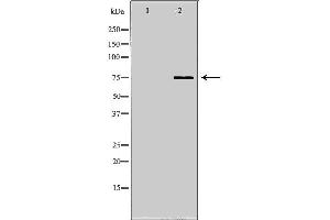 Western blot analysis of K562 whole cell lysates, using NDC80 Antibody. (NDC80 抗体  (C-Term))