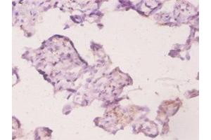 Immunohistochemistry of paraffin-embedded human placenta tissue using ABIN7174460 at dilution of 1:20 (UBE2K 抗体  (AA 2-200))