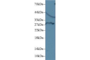 Detection of DIO3 in Rat Liver lysate using Polyclonal Antibody to Deiodinase, Iodothyronine, Type III (DIO3) (DIO3 抗体  (AA 37-169))