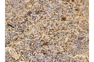 RIMS2 Mouse Monoclonal Antibody at 1/100 staining rat spleen tissue by IHC-P. (RIMS2 抗体)