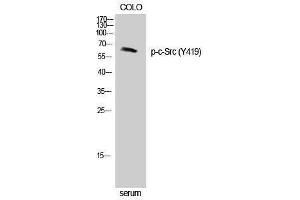 Western Blotting (WB) image for anti-Proto-oncogene tyrosine-protein kinase Src (Src) (pTyr419) antibody (ABIN3179423) (Src 抗体  (pTyr419))