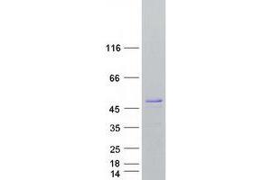 Validation with Western Blot