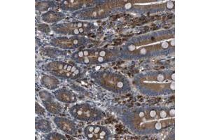 Immunohistochemical staining of human duodenum with EDARADD polyclonal antibody  shows distinct positivity in glandular cells at 1:50-1:200 dilution. (EDARADD 抗体)