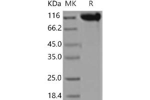 Selectin E (SELE) (Active) protein (Fc Tag)