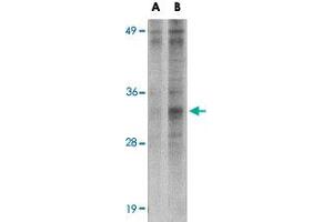 Western blot analysis of METTL7B in Jurkat cell lysate with METTL7B polyclonal antibody  at (A) 2 and (B) 4 ug/mL . (METTL7B 抗体  (N-Term))