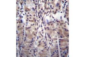 Immunohistochemistry analysis in formalin fixed and paraffin embedded human stomach tissue reacted with MDM1 Antibody (C-term) followed which was peroxidase conjugated to the secondary antibody and followed by DAB staining. (MDM1 抗体  (C-Term))