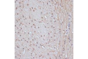 Immunohistochemistry of paraffin-embedded rat brain using SNW1 antibody (ABIN7270386) at dilution of 1:100 (40x lens). (SNW1 抗体  (AA 300-536))