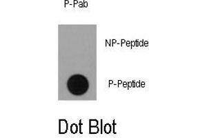 Image no. 1 for anti-Ribosomal Protein S6 Kinase, 90kDa, Polypeptide 1 (RPS6KA1) (pSer363) antibody (ABIN358393) (RPS6KA1 抗体  (pSer363))