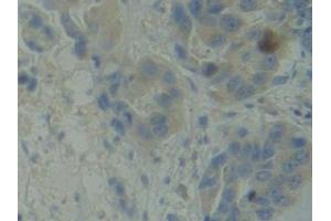 Immunohistochemistry (IHC) image for anti-BMX Non-Receptor Tyrosine Kinase (BMX) (AA 287-523) antibody (ABIN7443482)
