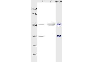 Lane 1: rat brain lysates Lane 2: human colon carcinoma lysates probed with Anti OLFM1/Noelin Polyclonal Antibody, Unconjugated (ABIN678308) at 1:200 in 4 °C. (Olfactomedin 1 抗体  (AA 101-200))