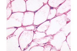 Staining of human adipocytes using SP4071 on paraffin sections (ADRB3 抗体  (Cytoplasmic Domain))
