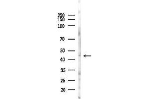 Western blot analysis of lysates from Hela cells(heat-shock 45 min treatment), using TRI Antibody at 1/1000 dilution.