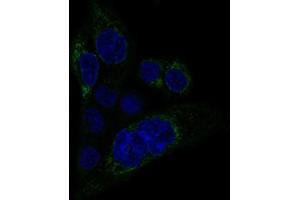 Immunofluorescent staining of A-431 cells with MACC1 monoclonal antibody, clone CL0856  (Green) shows specific staining in mitochondria. (MACC1 抗体)