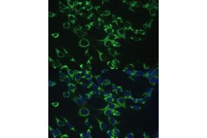 Immunofluorescence (IF) image for anti-Cytochrome C Oxidase Subunit Vb (COX5B) (AA 32-129) antibody (ABIN3016356)