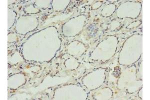 Immunohistochemistry of paraffin-embedded human thyroid tissue using ABIN7175073 at dilution of 1:100 (C11orf68 抗体  (AA 1-251))