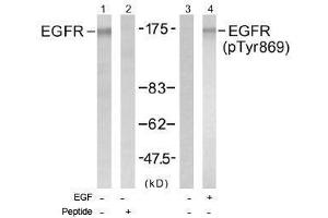 Image no. 1 for anti-Epidermal Growth Factor Receptor (EGFR) (pTyr869) antibody (ABIN196976) (EGFR 抗体  (pTyr869))