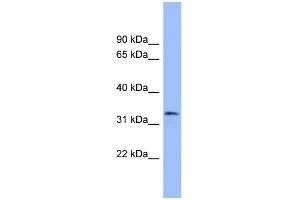 WB Suggested Anti-MAFB Antibody Titration: 0. (MAFB 抗体  (Middle Region))