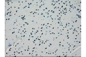 Image no. 5 for anti-Crystallin, alpha B (CRYAB) antibody (ABIN1497641) (CRYAB 抗体)