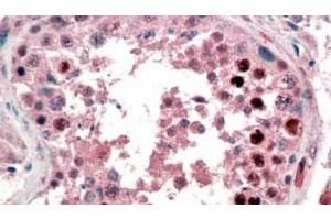 NANOG polyclonal antibody  (2 ug/mL) staining of paraffin embedded human testis. (Nanog 抗体  (C-Term))