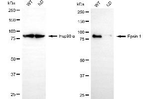 Western blotting analysis using epsin 1 antibody (ABIN7798487). (Recombinant Epsin 1 抗体)