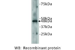 Image no. 2 for anti-Cadherin EGF LAG Seven Pass G-Type Receptor 2 (CELSR2) antibody (ABIN1112870) (CELSR2 抗体)