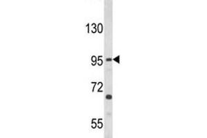 Western blot analysis of TLR3 antibody and HL-60 lysate. (TLR3 抗体)