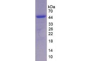 SDS-PAGE analysis of Chicken Interleukin 17 Protein.