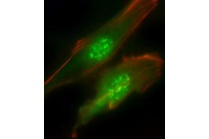 Immunofluorescence (IF) image for anti-Phosphoinositide 3 Kinase, p85 alpha (PI3K p85a) (AA 1-30), (N-Term) antibody (ABIN392570)