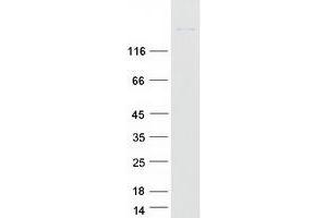 Western Blotting (WB) image for Insulin-Like Growth Factor 1 Receptor (IGF1R) protein (Myc-DYKDDDDK Tag) (ABIN2713509)