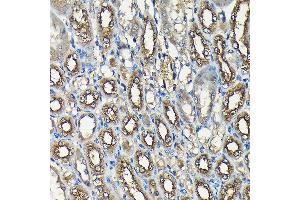 Immunohistochemistry (IHC) image for anti-Ubiquitin Specific Peptidase 5 (USP5) (AA 1-280) antibody (ABIN1683231)