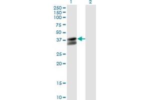 Western Blot analysis of PDHB expression in transfected 293T cell line by PDHB monoclonal antibody (M03), clone 2B2. (PDHB 抗体  (AA 250-359))