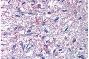 Immunohistochemical (Formalin/PFA-fixed paraffin-embedded sections) staining in human pituitary with GPR50 polyclonal antibody . (GPR50 抗体  (C-Term))
