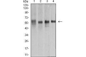 Western blot analysis using KRT10 mouse mAb against A431 (1), COS7 (2), Jurkat (3), and HEK293 (4) cell lysate. (Keratin 10 抗体  (AA 345-454))