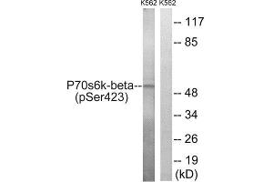 Western Blotting (WB) image for anti-Ribosomal Protein S6 Kinase, 70kDa, Polypeptide 2 (RPS6KB2) (pSer423) antibody (ABIN1847635) (RPS6KB2 抗体  (pSer423))