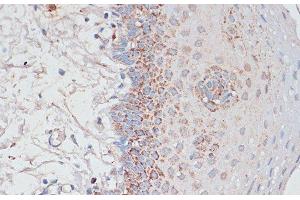 Immunohistochemistry of paraffin-embedded Human tonsil using Desmoplakin Polyclonal Antibody at dilution of 1:100 (40x lens).