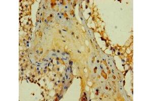 Immunohistochemistry of paraffin-embedded human testis tissue using ABIN7166618 at dilution of 1:100 (PRY 抗体  (AA 13-147))