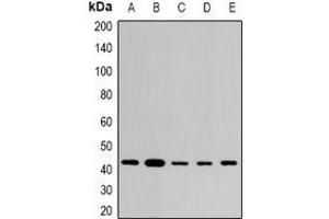 Western blot analysis of STX expression in THP1 (A), SKOV3 (B), mouse brain (C), mouse lung (D), rat heart (E) whole cell lysates. (ST8SIA2 抗体)